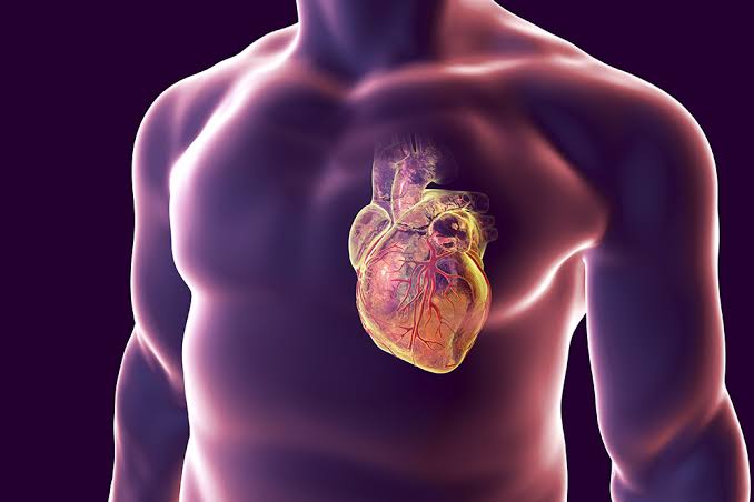 Cardiomiopatía Dilatada